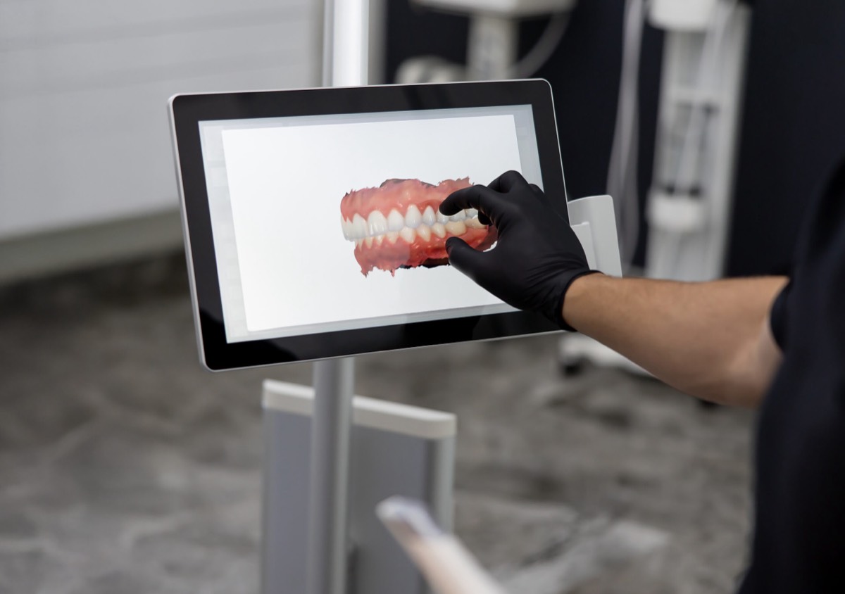 Team member reviewing a 3D digital scan of a patient’s teeth on a monitor