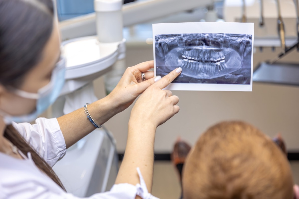 Digital scan of a patient's teeth being reviewed